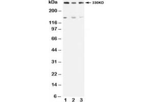 Western blot testing of ATM antibody and Lane 1:  rat testis;  2: U87;  3: MCF-7 (ATM anticorps  (N-Term))