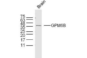 Mouse brain lysates probed with GPM6B Polyclonal Antibody, unconjugated  at 1:300 overnight at 4°C followed by a conjugated secondary antibody at 1:10000 for 90 minutes at 37°C. (GPM6B anticorps  (AA 1-100))