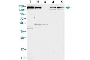 Western blot analysis of Lane 1: RT-4, Lane 2: U-251 MG, Lane 3: Human Plasma, Lane 4: Liver, Lane 5: Tonsil with UGCGL1 polyclonal antibody . (UGGT1 anticorps)