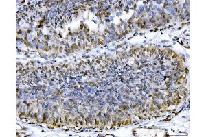 IHC analysis of ACLY using anti-ACLY antibody (ABIN4886416).