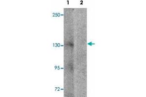 Western blot analysis of NLRP7 in human brain tissue lysate with NLRP7 polyclonal antibody  at 1 ug/mL in (1) the absence and (2) the presence of blocking peptide. (NLRP7 anticorps  (N-Term))