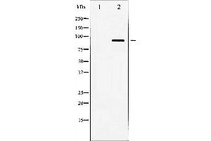 Western blot analysis of HSL expression in Jurkat whole cell lysates,The lane on the left is treated with the antigen-specific peptide. (LIPE anticorps  (Internal Region))