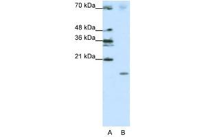 SRP19 antibody used at 1. (SRP19 anticorps  (Middle Region))