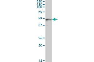 PAX8 monoclonal antibody (M09), clone 3H7.
