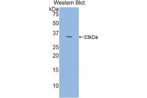Western Blotting (WB) image for anti-Histidine Decarboxylase (HDC) (AA 365-643) antibody (ABIN1859133) (HDC anticorps  (AA 365-643))