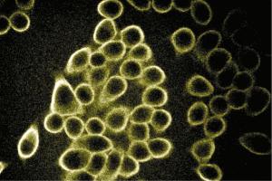 Immunofluorescent staining of Hela cells (Human cervical epitheloid carcinoma, ATCC CCL-2. (SPTBN1 anticorps  (AA 2101-2189))