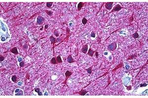 Human Brain, Cortex: Formalin-Fixed, Paraffin-Embedded (FFPE)