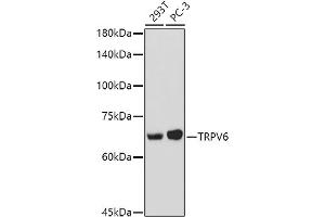 Western blot analysis of extracts of various cell lines, using TRPV6 antibody (ABIN7270921) at 1:1000 dilution.