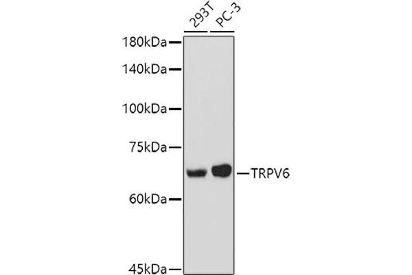 TRPV6 Antikörper  (AA 1-100)