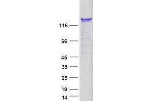 Validation with Western Blot