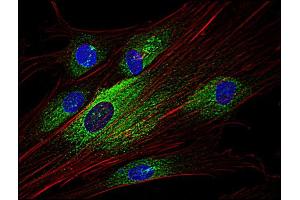 Immunofluorescence staining of Syk in human primary fibroblasts using anti-Syk (; green).