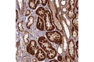 Immunohistochemical staining of human kidney with EARS2 polyclonal antibody  shows strong cytoplasmic positivity in renal tubules at 1:10 - 1:20 dilution. (EARS2 anticorps)