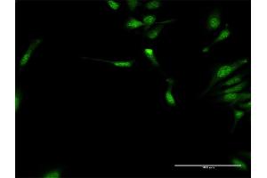 Immunofluorescence of purified MaxPab antibody to DYX1C1 on HeLa cell. (DYX1C1 anticorps  (AA 1-381))