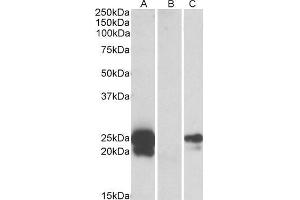 HEK293 lysate (10ug protein in RIPA buffer) overexpressing Human WFDC2 with C-terminal MYC tag probed with ABIN571149 (1ug/ml) in Lane A and probed with anti-MYC Tag (1/1000) in lane C.