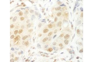 Immunohistochemistry (IHC) image for anti-UTP6, Small Subunit (SSU) Processome Component, Homolog (UTP6) (AA 565-597) antibody (ABIN7453495)