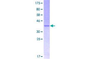 Image no. 1 for Twist Homolog 1 (Drosophila) (TWIST1) (AA 100-202) protein (GST tag) (ABIN1324200)