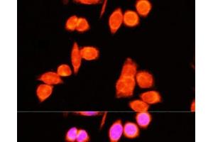 Immunofluorescence analysis of Hela cells using DNAJC19 Polyclonal Antibody at dilution of 1:100 (40x lens). (DNAJC19 anticorps)