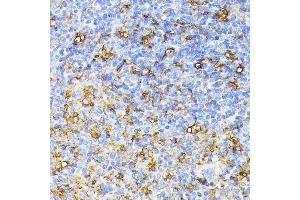Immunohistochemistry of paraffin-embedded mouse spleen using FLT1 antibody (ABIN6132264, ABIN6140687, ABIN6140689 and ABIN6216515) at dilution of 1:100 (40x lens). (FLT1 anticorps  (AA 20-300))