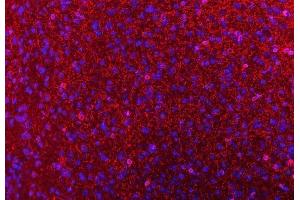 IF analysis of CNPase/CNP using anti-CNPase/CNP antibody (ABIN7599377).