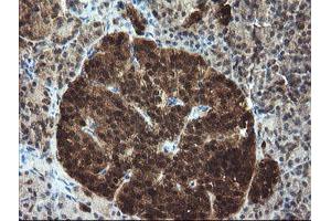 Image no. 1 for anti-Tubulin Folding Cofactor C (TBCC) antibody (ABIN1501323)