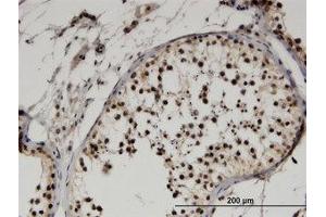 Image no. 2 for anti-F-Box Protein 9 (FBXO9) (AA 338-448) antibody (ABIN599547) (FBXO9 anticorps  (AA 338-448))
