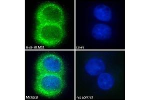 (ABIN184952) Immunofluorescence analysis of paraformaldehyde fixed HepG2 cells, permeabilized with 0. (ALMS1 anticorps  (C-Term))