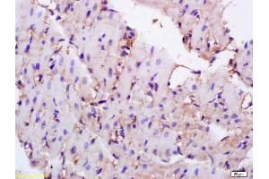 Formalin-fixed and paraffin embedded rat heart labeled with Anti-CD36/PAS-4 Polyclonal Antibody, Unconjugated (ABIN737661) at 1:200 followed by conjugation to the secondary antibody and DAB staining.