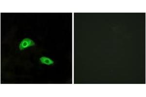 Immunofluorescence analysis of HeLa cells, using GPR174 Antibody. (GPR174 anticorps  (AA 126-175))