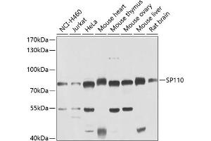 Western blot analysis of extracts of various cell lines, using SP110 antibody (ABIN6128744, ABIN6148311, ABIN6148313 and ABIN6223389) at 1:1000 dilution. (SP110 anticorps  (AA 1-290))