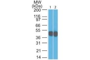 Western Blot Analysis (1) HeLa and (2) A431 lysate using Cytokeratin 18 Mouse Monoclonal Antibody (DC10). (Cytokeratin 18 anticorps)
