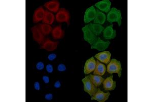 ABIN6259338 and ABIN6275436 staining Hela cells(45 min of heat-shock) by IF/ICC. (RAB3GAP2 anticorps  (Internal Region))