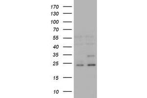 Image no. 4 for anti-RAB21, Member RAS Oncogene Family (RAB21) antibody (ABIN1500547) (RAB21 anticorps)