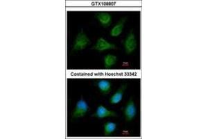 Image no. 2 for anti-Calcium Channel, Voltage-Dependent, beta 1 Subunit (CACNB1) (AA 360-523) antibody (ABIN467509)