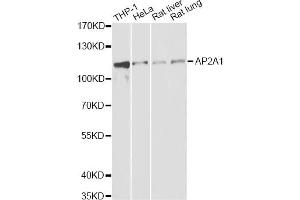 Western blot analysis of extracts of various cell lines, using AP2A1 antibody. (alpha Adaptin anticorps)