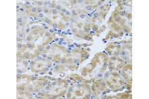 Immunohistochemistry of paraffin-embedded Rat kidney using PER1 Polyclonal Antibody at dilution of 1:100 (40x lens). (PER1 anticorps)