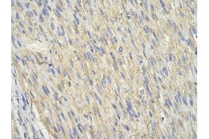 Rabbit Anti-SIAH1 antibody        Paraffin Embedded Tissue:  Human Heart cell   Cellular Data:  Epithelial cells of renal tubule  Antibody Concentration:   4.