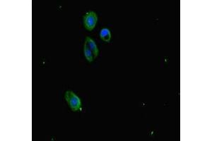 Immunofluorescence staining of HepG2 cells with ABIN7163811 at 1:333, counter-stained with DAPI. (SUZ12 anticorps  (AA 131-305))