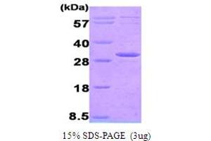 SDS-PAGE (SDS) image for Adenylate Kinase 3 (AK3) (AA 1-223) protein (His tag) (ABIN666626)