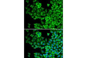 Immunofluorescence analysis of A549 cell using HCK antibody. (HCK anticorps)