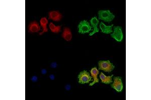 Citrate synthetase Antibody staining Hela cells by IF/ICC. (Citrate Synthetase (C-Term) anticorps)