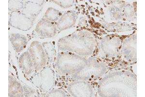 IHC-P Image Immunohistochemical analysis of paraffin-embedded human lymphocytes in gastric epithelium, using HCLS1, antibody at 1:100 dilution. (HCLS1 anticorps  (C-Term))