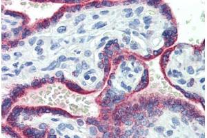 anti-Set1/Ash2 Histone Methyltransferase Complex Subunit ASH2 (ASH2L) (AA 288-337) antibody