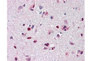 Anti-ANP32A antibody IHC of human brain, cortex.