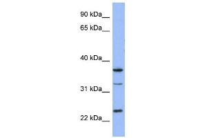 WB Suggested Anti-SOX21 Antibody Titration: 0. (SOX21 anticorps  (Middle Region))