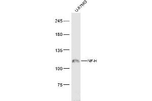 U-87MG lysates probed with NF-H Polyclonal Antibody, Unconjugated  at 1:300 dilution and 4˚C overnight incubation. (NEFH anticorps  (AA 21-120))