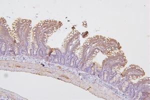 IHC analysis of PRKCD using anti-PRKCD antibody (ABIN7601631).