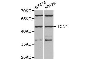 Western blot analysis of extracts of various cell lines, using TCN1 antibody. (TCN1 anticorps)