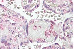 Anti-LYN antibody IHC staining of human placenta. (LYN anticorps  (AA 39-58))