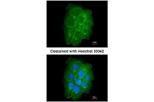 AP31081PU-N CAV2 antibody staining of Paraformaldehyde-Fixed A431 by Immunofluorescence at 1/200 dilution.