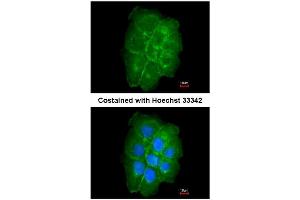 AP31081PU-N CAV2 antibody staining of Paraformaldehyde-Fixed A431 by Immunofluorescence at 1/200 dilution. (Caveolin 2 anticorps  (AA 1-45))